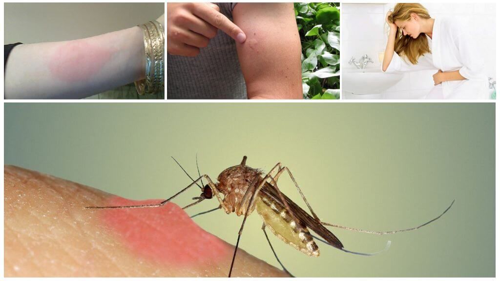 Наслідки укусу комара