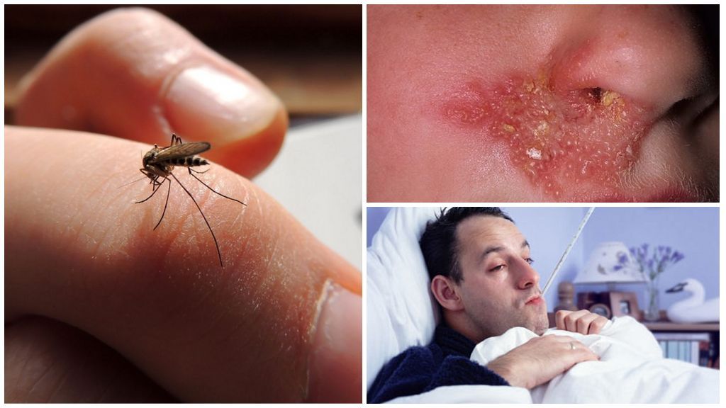 Малярія від комарів