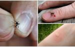 Чому комарі кусають одних людей більше ніж інших