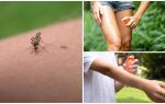 Кращі засоби від комарів – огляд, ціни і відгуки