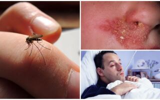 Чи може комар заразити СНІДом, ВІЛ або іншими хворобами