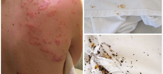 Як дізнатися, чи є клопи в квартирі