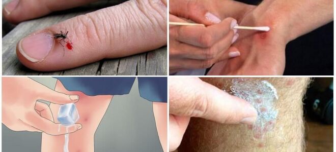 Чим мазати укуси комарів, щоб вони не свербіли і гоїлися