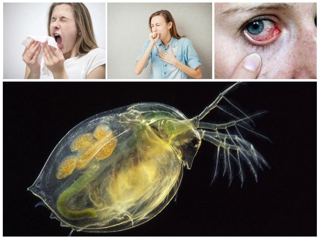 Алергія на водяних бліх